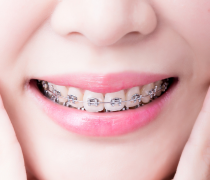 KLINIK ORTHODONTI